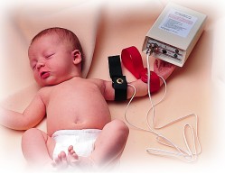 Wescor, IncMacroduct and Sweat Inducer